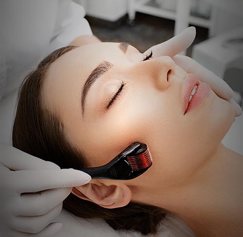Microneedling